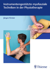 Instrumentengestützte myofasziale Techniken in der Physiotherapie - Jürgen Förster - E-Book