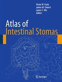 Atlas of Intestinal Stomas -  - E-Book