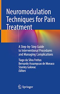Neuromodulation Techniques for Pain Treatment -  - E-Book