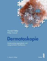 Dermatoskopie - Harald Kittler - E-Book