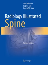 Radiology Illustrated: Spine - Joon Woo Lee - E-Book