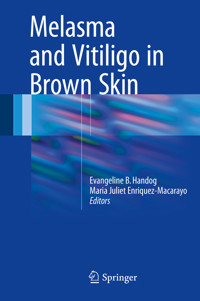 Melasma and Vitiligo in Brown Skin -  - E-Book