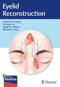 Eyelid Reconstruction - Suzanne K. Freitag - E-Book