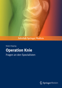Operation Knie - Robert Kipping - E-Book