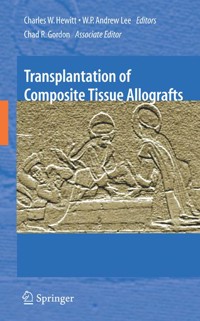 Transplantation of Composite Tissue Allografts -  - E-Book