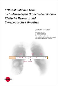 EGFR-Mutationen beim nichtkleinzelligen Bronchialkarzinom - Klinische Relevanz und therapeutisches Vorgehen - Martin Sebastian - E-Book
