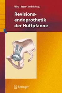 Revisionsendoprothetik der Hüftpfanne -  - E-Book