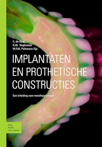 Implantaten en prothetische constructies - C. de Baat - E-Book