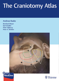 The Craniotomy Atlas -  - E-Book