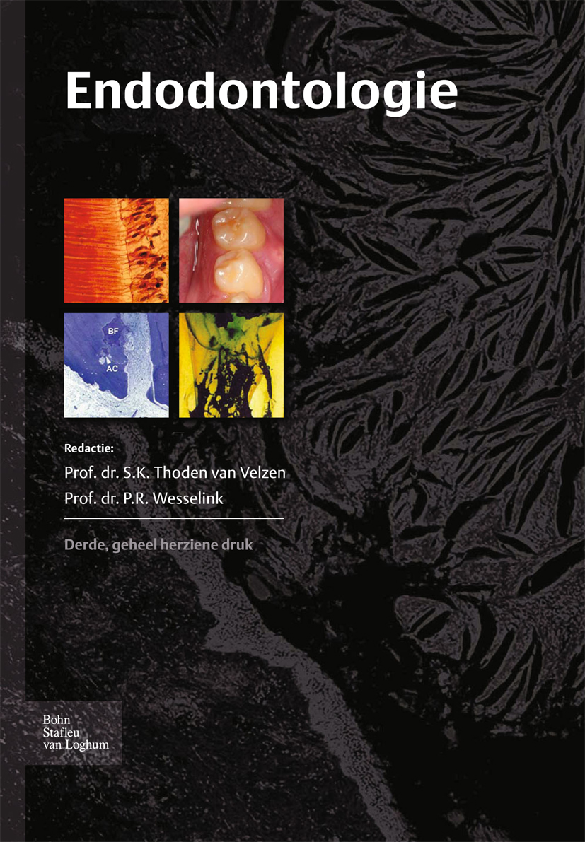 Endodontologie - S.K. Thoden van Velzen - E-Book