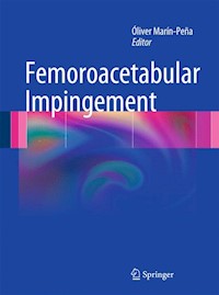 Femoroacetabular Impingement -  - E-Book