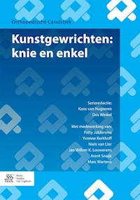 Kunstgewrichten: knie en enkel - Koos van Nugteren - E-Book