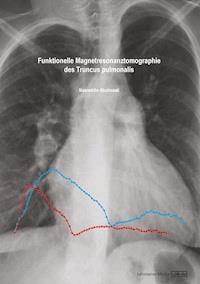 Funktionelle Magnetresonanztomographie des Truncus pulmonalis - Nasreddin Abolmaali - E-Book