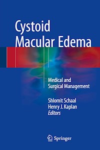 Cystoid Macular Edema -  - E-Book