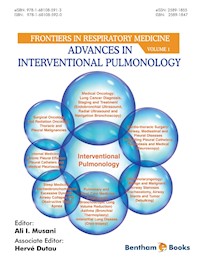Advances in Interventional Pulmonology -  - E-Book
