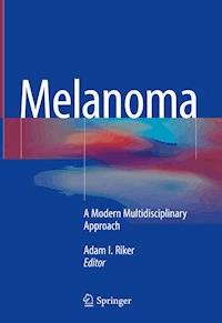 Melanoma -  - E-Book