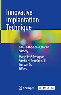 Innovative Implantation Technique -  - E-Book