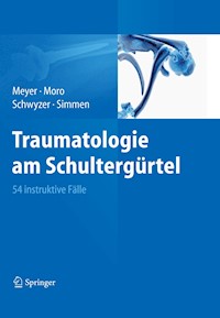Traumatologie am Schultergürtel - Rainer-Peter Meyer - E-Book