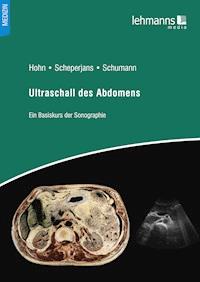 Ultraschall des Abdomens -  - E-Book