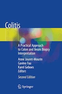 Colitis -  - E-Book