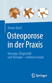 Osteoporose in der Praxis - Reiner Bartl - E-Book