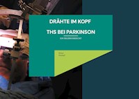 Drähte im Kopf THS bei Parkinson - Klaus Stumpf - E-Book