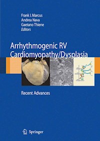 Arrhythmogenic RV Cardiomyopathy/Dysplasia -  - E-Book