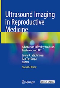 Ultrasound Imaging in Reproductive Medicine - - E-Book
