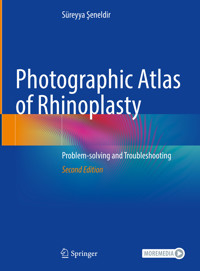 Photographic Atlas of Rhinoplasty - Süreyya Şeneldir - E-Book