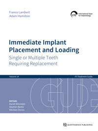 Immediate Implant Placement and Loading – Single or Multiple Teeth Requiring Replacement - France Lambert - E-Book