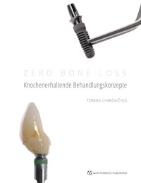 Zero Bone Loss: Knochenerhaltende Behandlungskonzepte - Tomas Linkevičius - E-Book