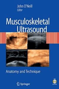 Musculoskeletal Ultrasound -  - E-Book