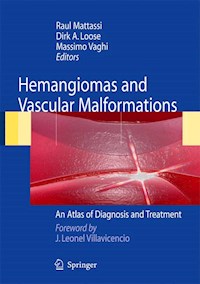 Hemangiomas and Vascular Malformations - - E-Book