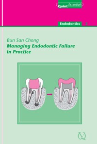Managing Endodontic Failure in Practice - Bun San Chong - E-Book