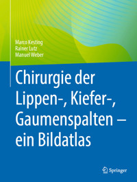Chirurgie der Lippen-, Kiefer-, Gaumenspalten – ein Bildatlas - Marco Kesting - E-Book