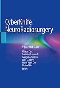 CyberKnife NeuroRadiosurgery -  - E-Book