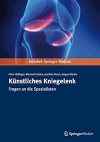 Künstliches Kniegelenk - Peter Aldinger - E-Book