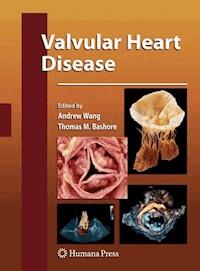 Valvular Heart Disease -  - E-Book