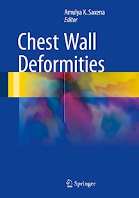 Chest Wall Deformities -  - E-Book