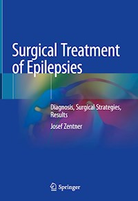 Surgical Treatment of Epilepsies - Josef Zentner - E-Book