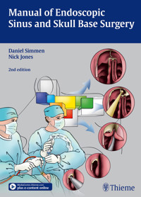 Manual of Endoscopic Sinus and Skull Base Surgery -  - E-Book
