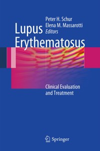 Lupus Erythematosus - - E-Book