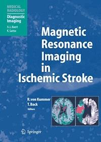 Magnetic Resonance Imaging in Ischemic Stroke - - E-Book