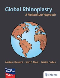 Global Rhinoplasty - Ashkan Ghavami - E-Book