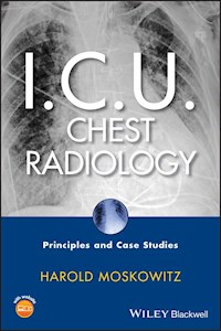 I.C.U. Chest Radiology - Harold Moskowitz - E-Book