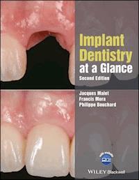 Implant Dentistry at a Glance - Jacques Malet - E-Book