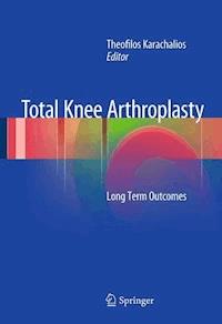 Total Knee Arthroplasty -  - E-Book