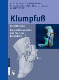 Klumpfuß - G.U. Exner - E-Book