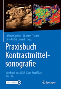 Praxisbuch Kontrastmittelsonografie -  - E-Book