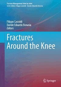 Fractures Around the Knee -  - E-Book